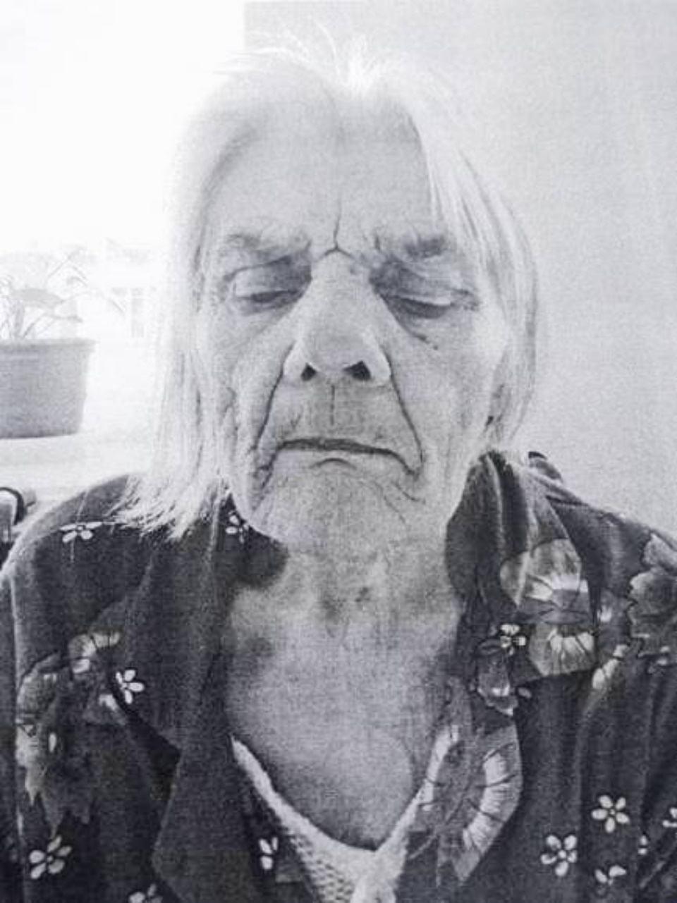 В псковской больнице не могут установить личность пациентки (ФОТО)