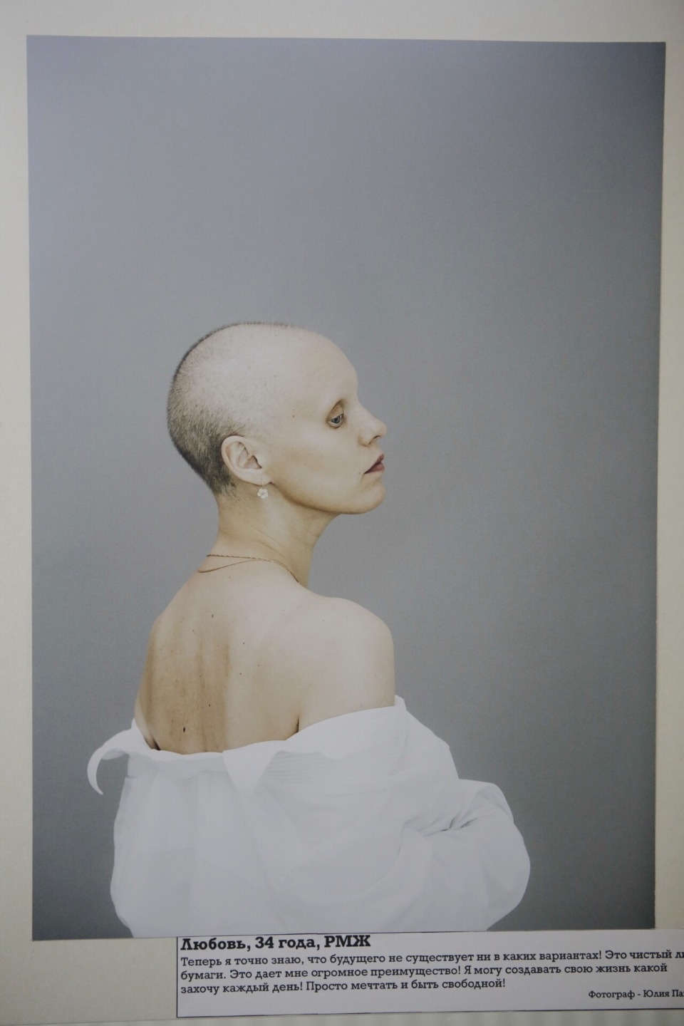 Пациенты с онкологией объединились для помощи псковичам с тем же диагнозом