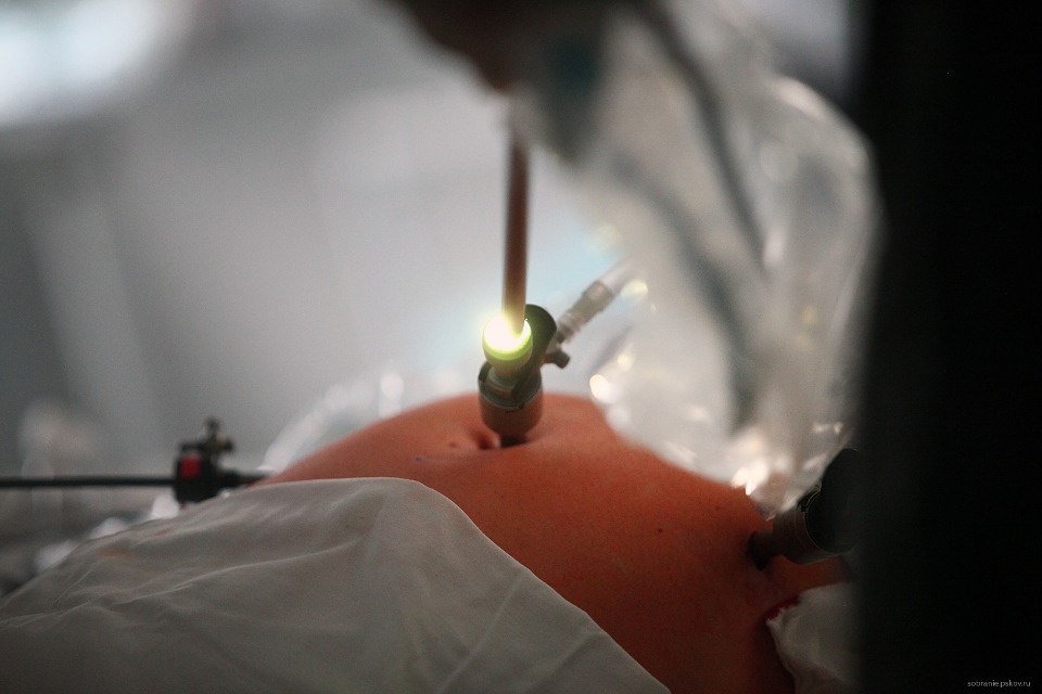 Каждая пятая операция в Псковской областной больнице проводится малоинвазивным способом