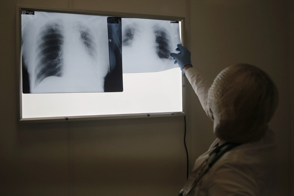 Еще 295 жителей Псковской области заразились коронавирусом за сутки