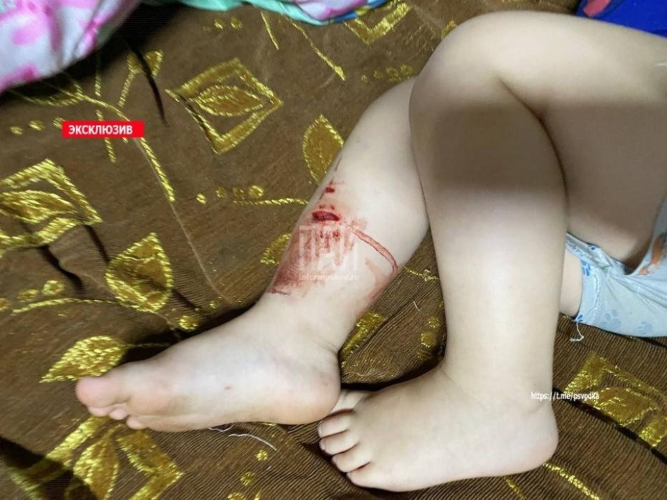 Немецкая овчарка покусала двоих детей и их мать в Печорском районе 