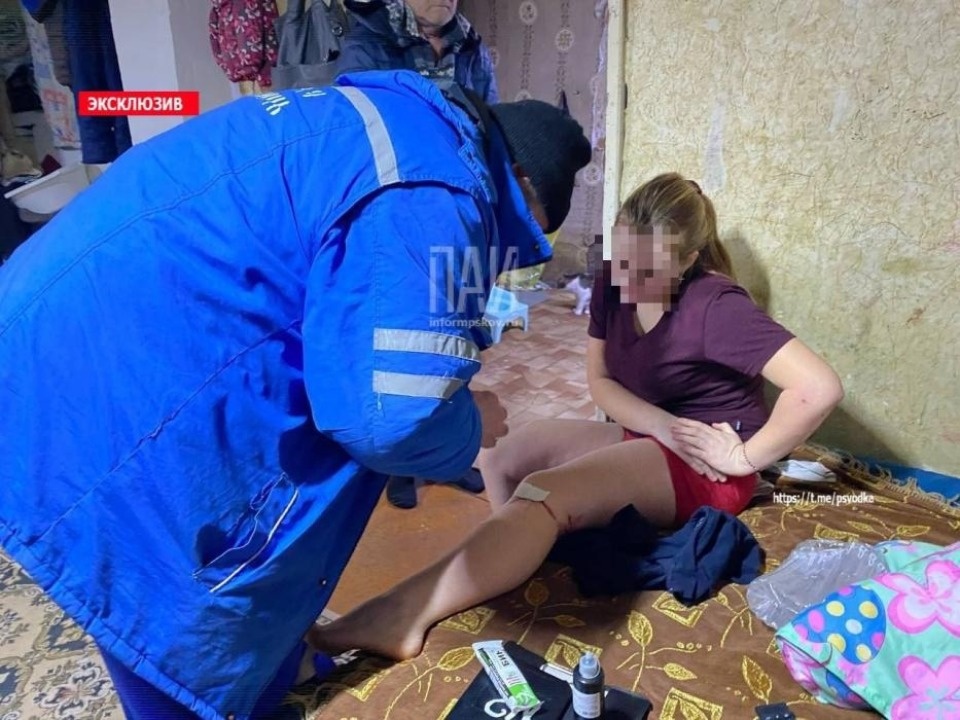 Немецкая овчарка покусала двоих детей и их мать в Печорском районе 