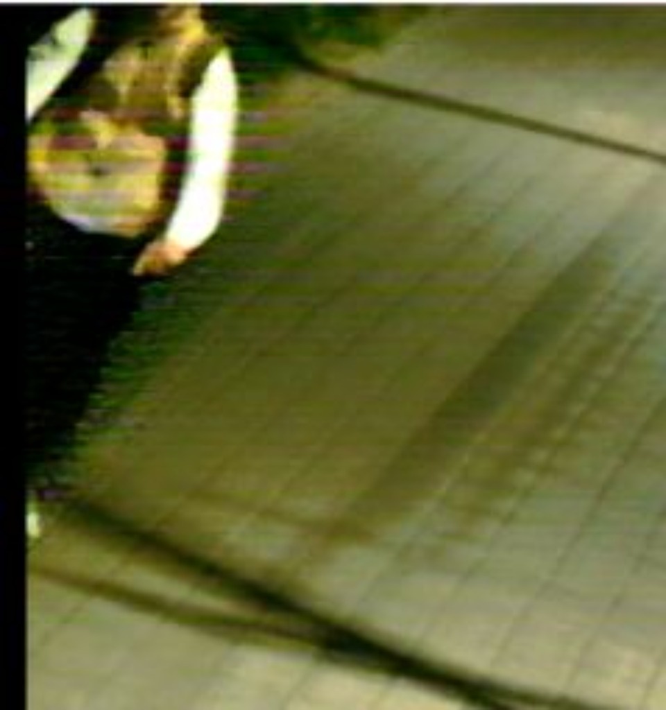 Полиция ищет свидетелей наезда водителя электросамоката на девушку в Финском парке в Пскове