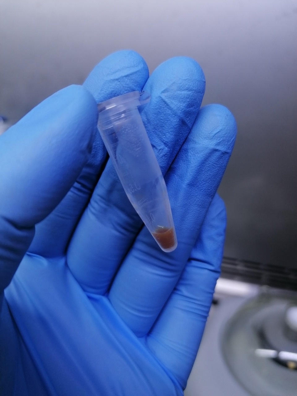 В Псковской области зафиксировали первый случай укуса клеща