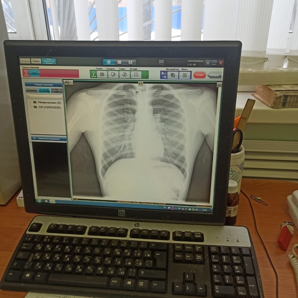 Рентген-аппарат отремонтировали в Детской областной больнице в Великих Луках