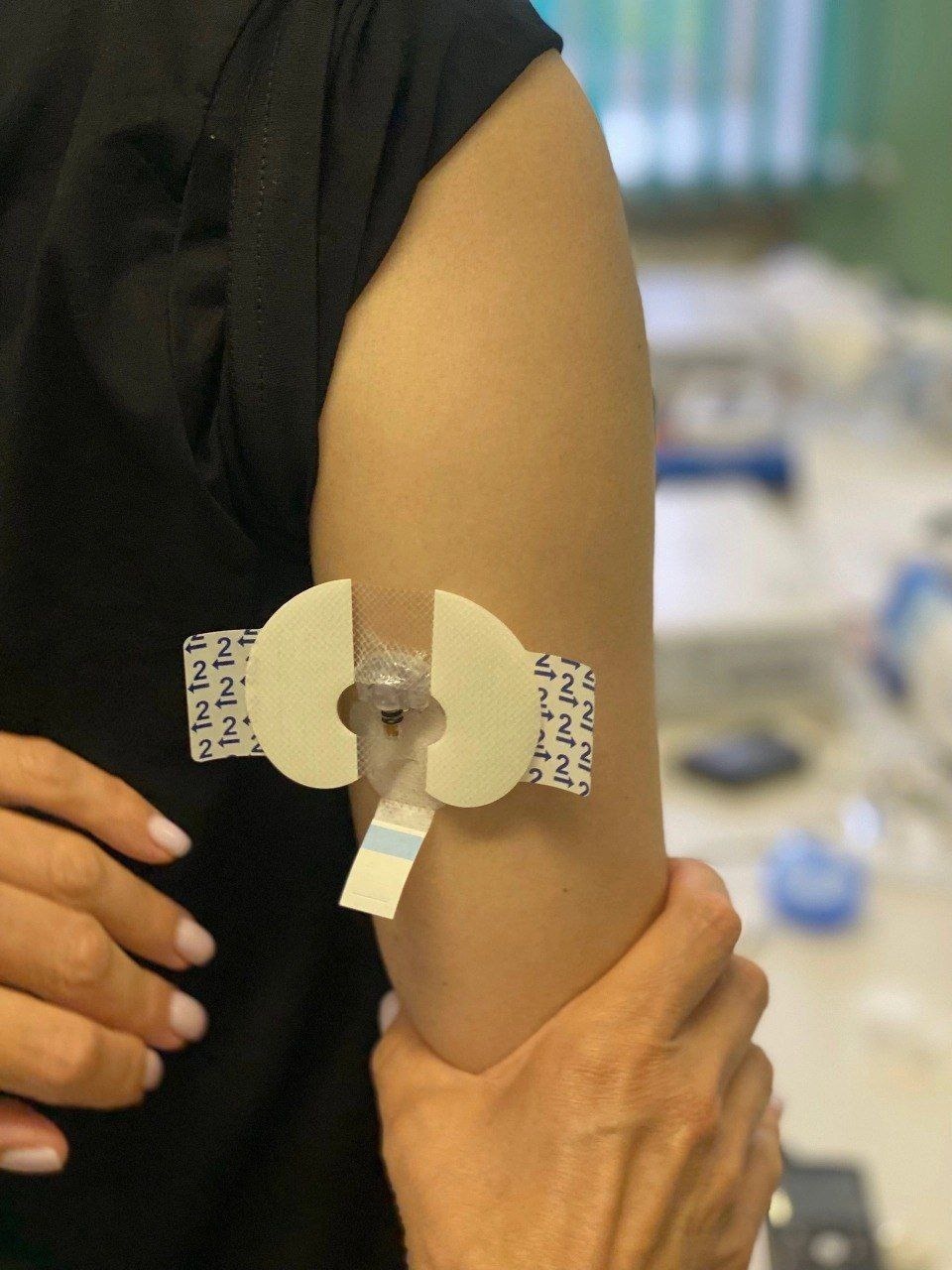 В Псковской области впервые начали устанавливать инсулиновые помпы