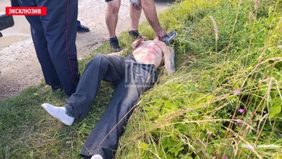 Мужчина получил ножевое ранение в Дно Мужчина получил ножевое ранение в Дно